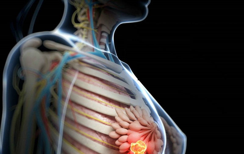 Alimentul pe care puțini îl consumă, dar care te apără de cancerul la sân
