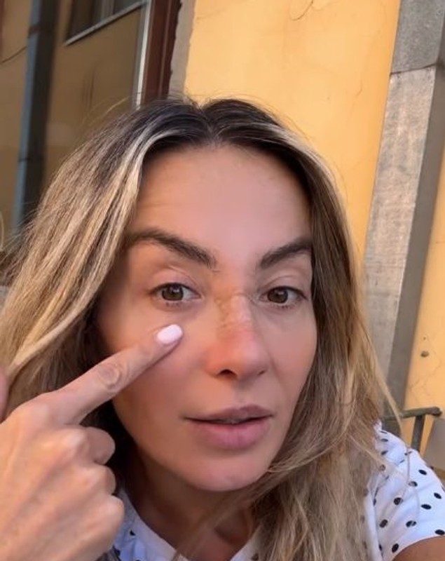 Flavia Mihășan după operația la nas