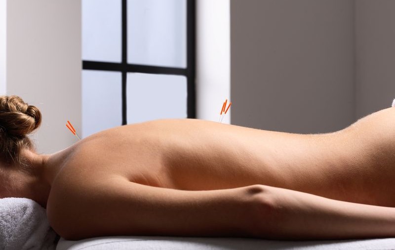 Acupunctura poate răspândi HIV