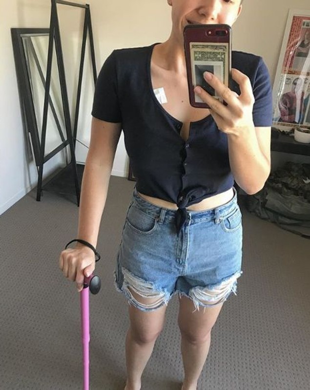 FOTO | O tânără a mințit pe internet că are cancer pentru a strânge bani. Imaginile prin care a reușit să stârnească mila oamenilor