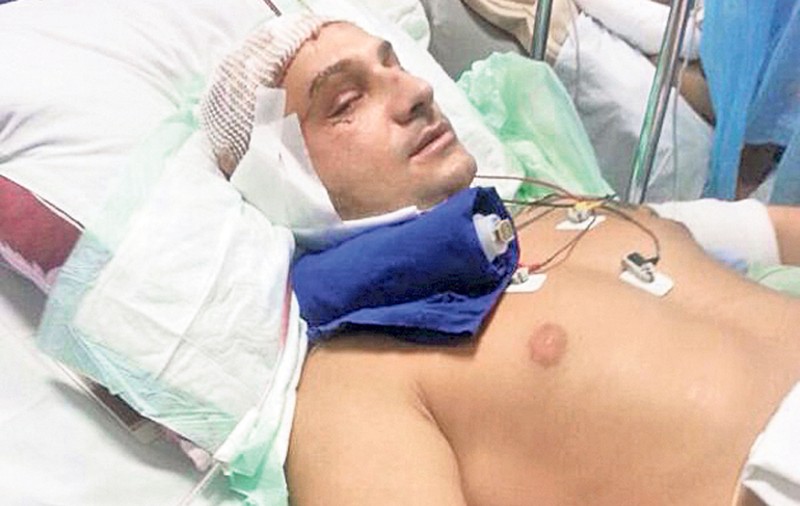 Desfigurat de la o şaorma! Un tânăr din Bucureşti e în stare gravă la spital în urma unui scandal
