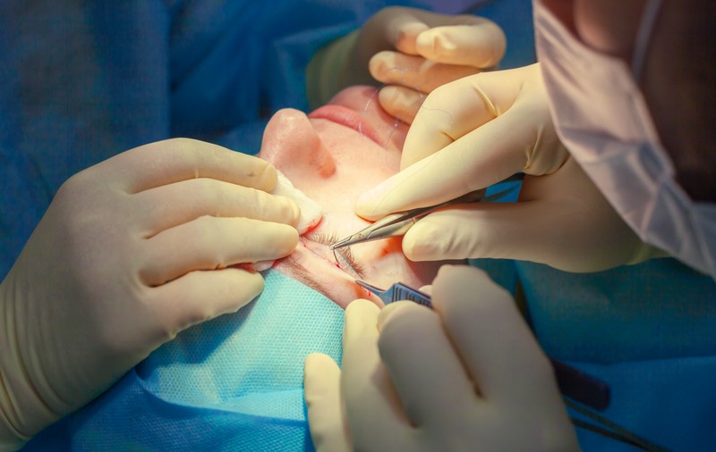 Chirurgia estetică, noua salvare pentru fugari și infractori. Țara asiatică unde spitale clandestine oferă servicii de „creare a unei persoane complet noi”