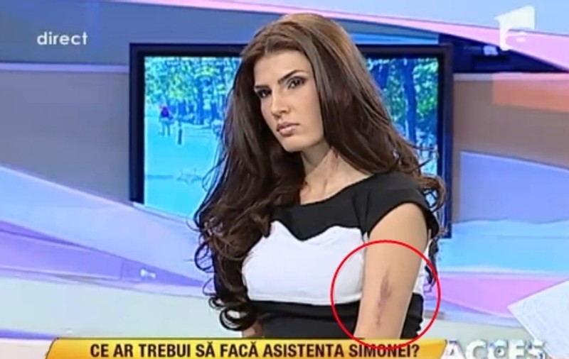Raluca Ogică, lovită de iubit în parc? "Nu le-am spus părinţilor, mi-a fost ruşine"