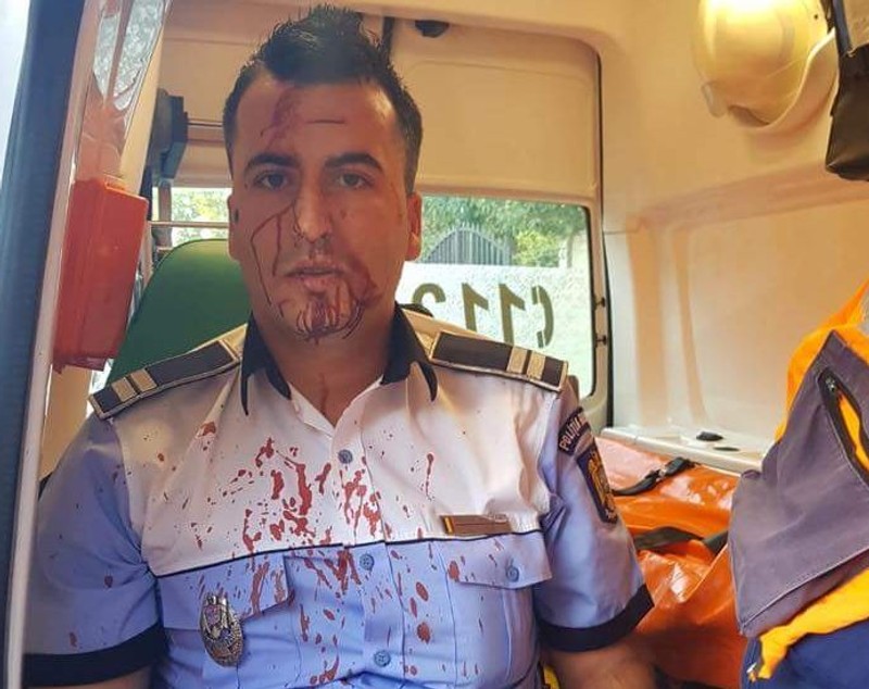 UPDATE. Polițist din Craiova, bătut cu telefonul mobil de un șofer pe care a încercat să-l rețină. Imagini șocante cu omul legii după agresiune