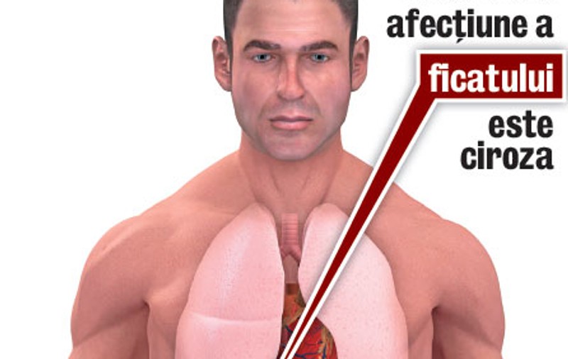 Băuturile alcoolice sunt foarte periculoase