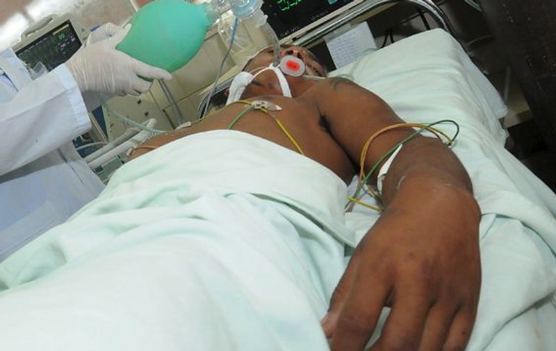 Un bărbat care a suferit un transplant de faţă şi mâini a murit