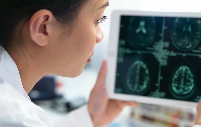 Prima țară din lume care a aprobat un implant cerebral comercial