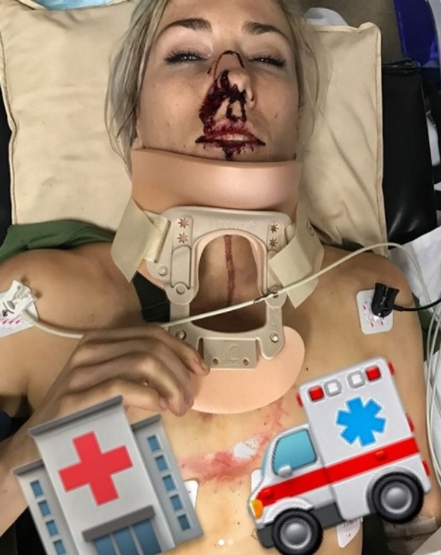 Frumoasa ciclistă Caroline Bouchanan a suferit răni grave după un accident de circulație! Atenție, imagini care vă pot afecta emoțional! Foto în articol