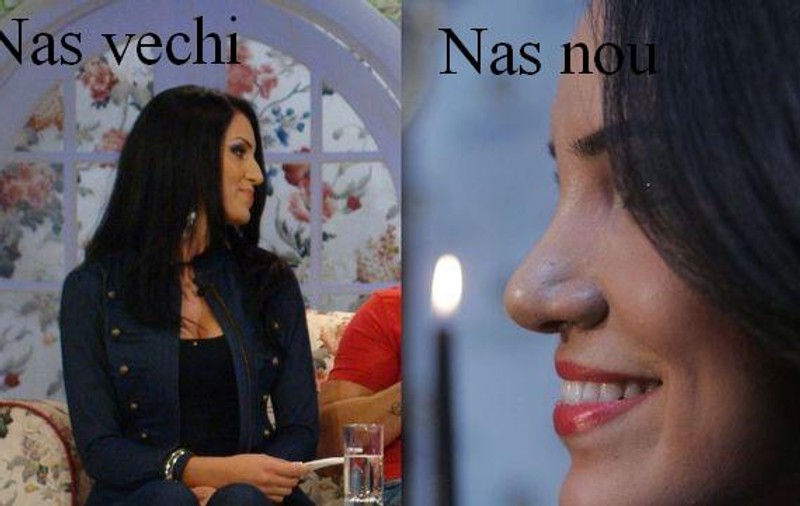 Adelina şi nasul buclucaş... Cum e mai frumoasă bruneta, cu vechiul sau cu noul nas?