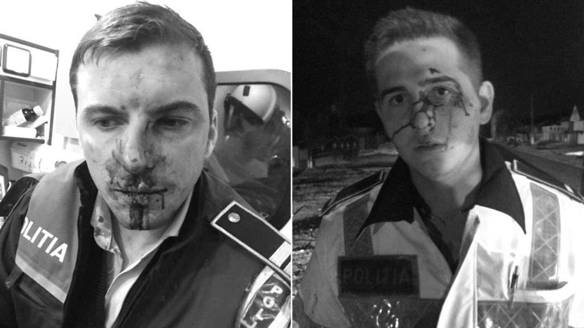 Precizările MAI în cazul polițiștilor bătuți și lăsați fără arme în Vâlcea. Unul dintre agenții agresați, transferat în București pentru a fi operat FOTO: observator.tv