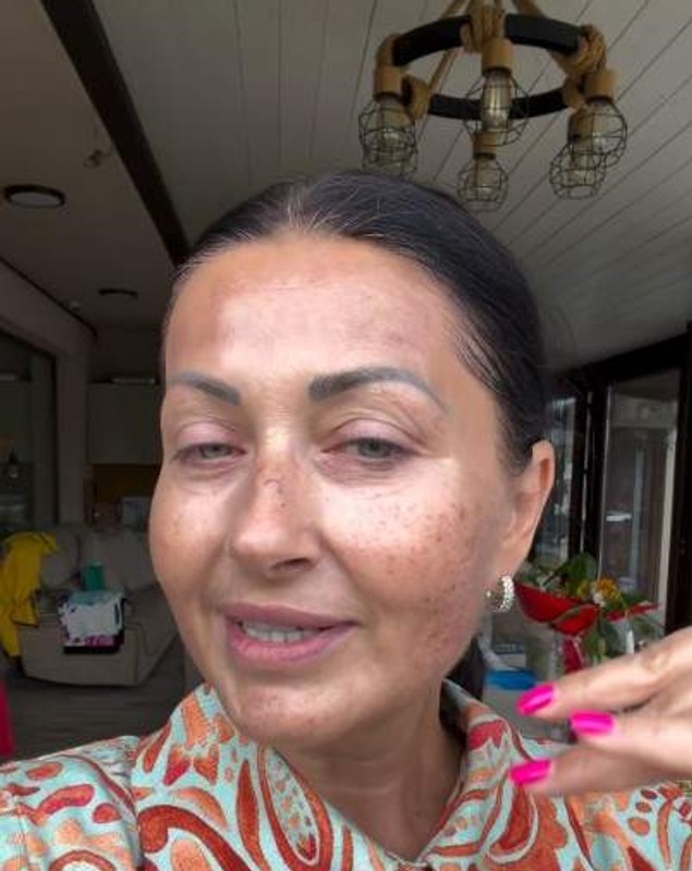 Gabriela Cristea și-a făcut terapie cu laser la față. Ce problemă a vrut să rezolve după cele două sarcini