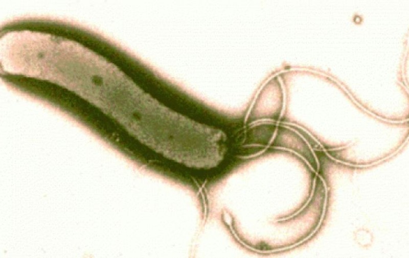 “Superbacteria” pe care nu o distruge nici un antibiotic a ucis o femeie