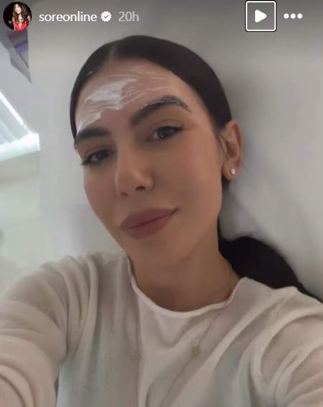 Sore s-a lăsat pe mâna medicului estetician. Ce intervenție și-a făcut la nivelul feței. „Mă doare capul. Nu mai pot așa”