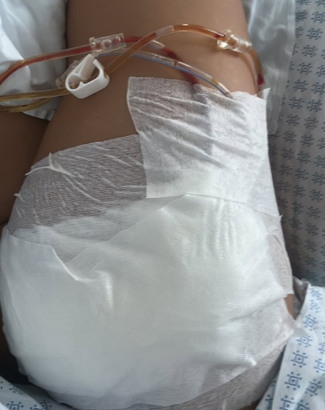 Antonia, de urgență la spital din cauza unei intervenții estetice: „Mi-am injectat Aquafilling ca să am un fund mai bombat”. A fost operată de trei ori și a fost la un pas de tragedie