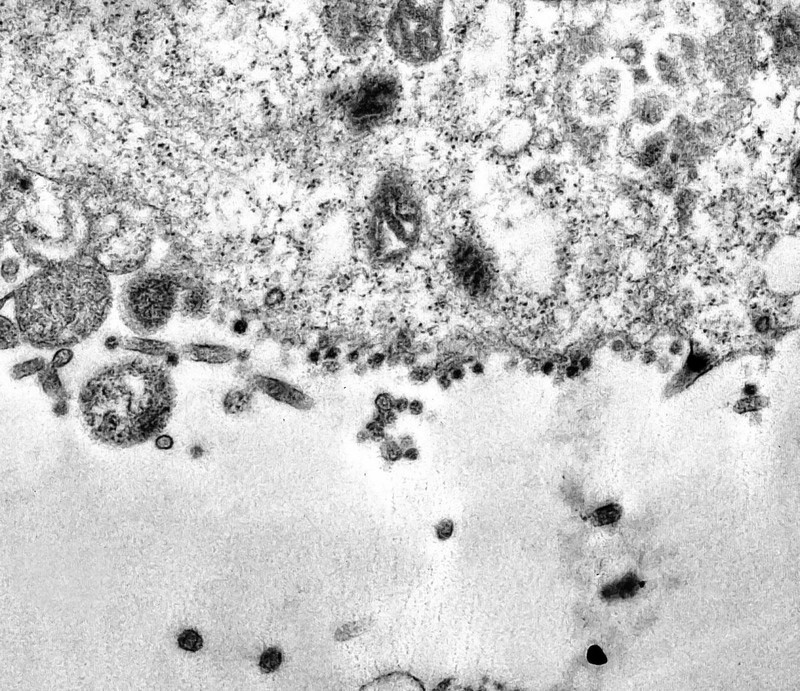 Particulele virale încearcă să infecteze celula (aflată în stânga fotografiei) FOTO: EPA