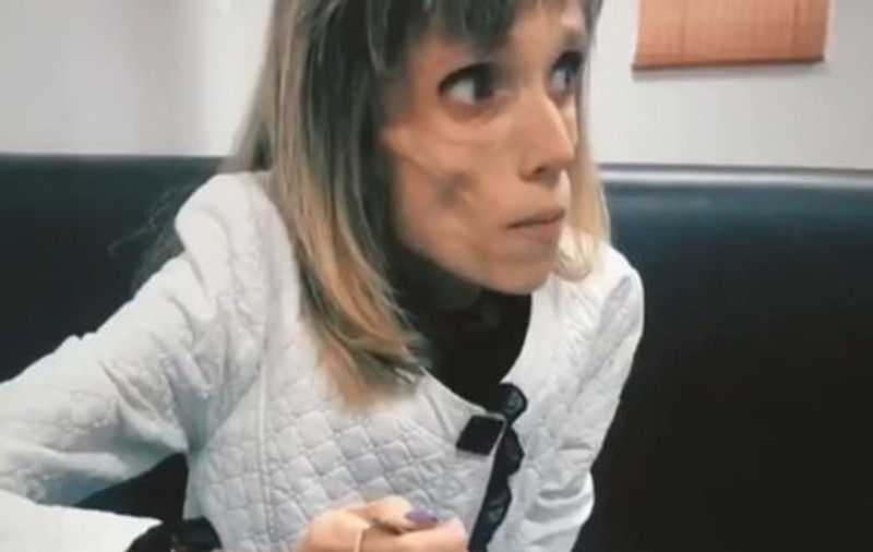 VIDEO | Cuvintele dure ale unui medic pentru o femeie anorexică: „Te-ai gândit vreodată să joci într-un film horror?”