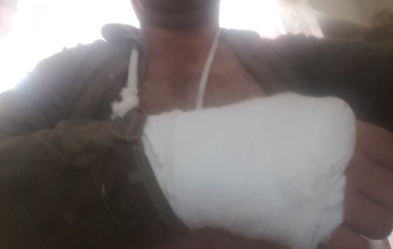 Poliția Locală Ploiești: Bărbatul care a acuzat ”mascații” că i-au rupt mâna și-a provocat singur rănile