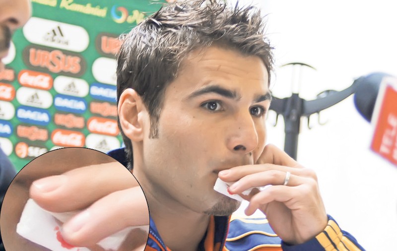 Foto | Adrian Mutu, cu buza spartă!