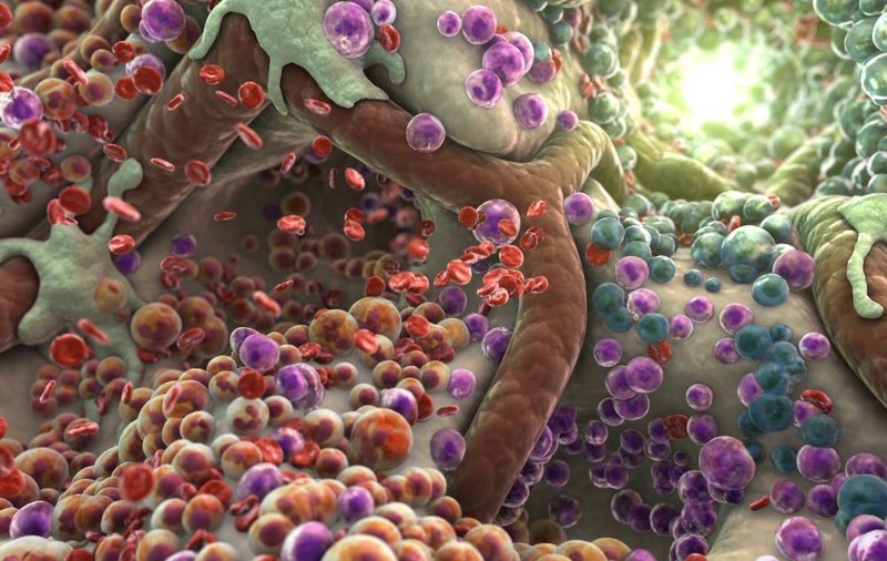 Cel mai agresiv tip de cancer de piele ar putea fi vindecat