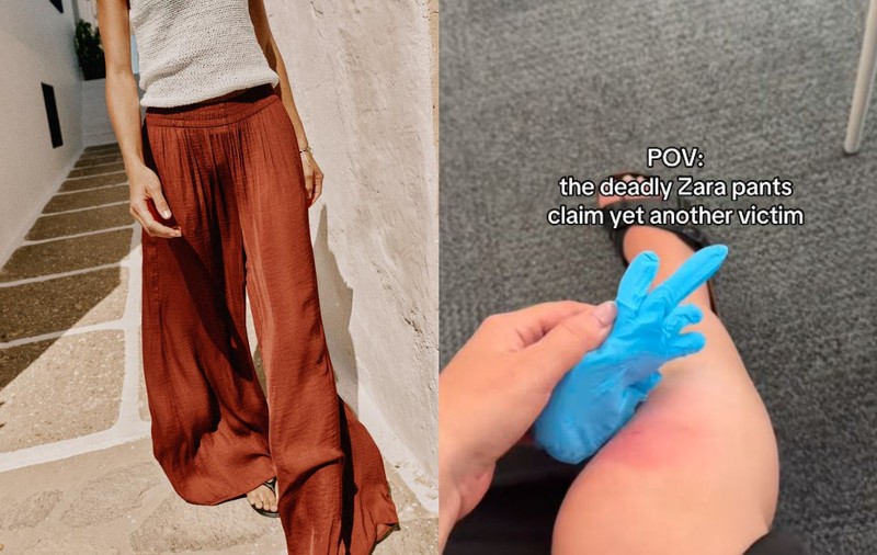 Pantalonii de la Zara considerați „mortali” la propriu și deveniți virali pe rețelele de socializare: mii de femei se împiedică de ei și se rănesc