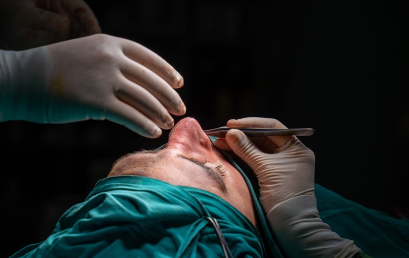 Rinoplastie estetică sau septoplastie? Diferențe și recomandări