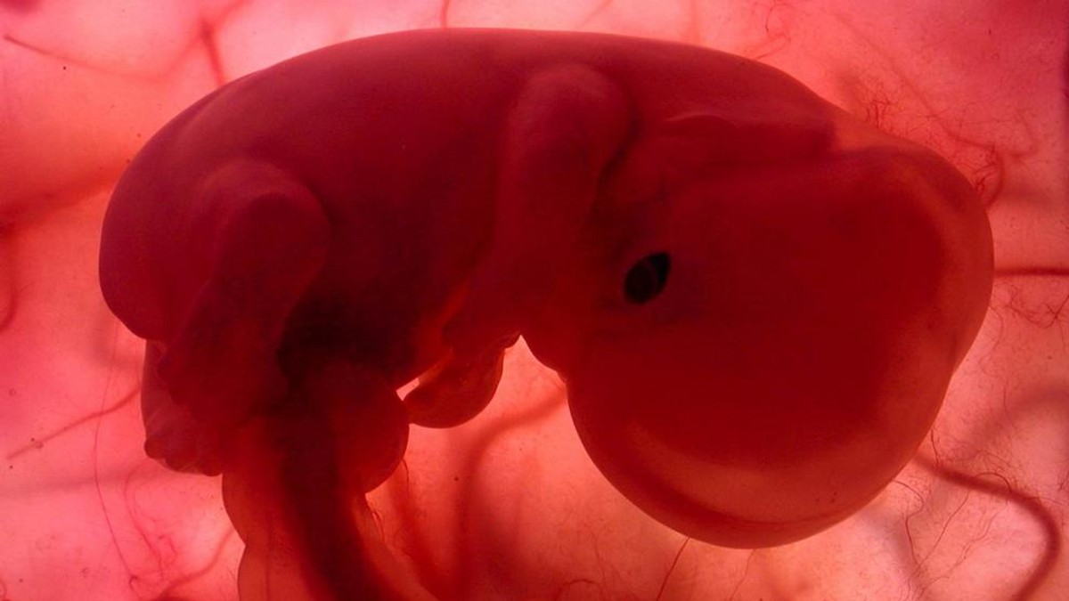 Femeile din Slovacia care vor să avorteze vor fi obligate să privească imaginea unui fetus și să-i asculte bătăile inimii