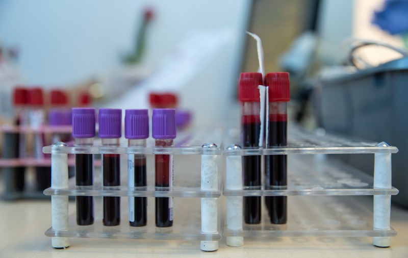 „Nu ne-am mai confruntat niciodată cu așa ceva”. Ce se întâmplă la Centrul de Transfuzii Sanguine din București în criza provocată de coronavirus