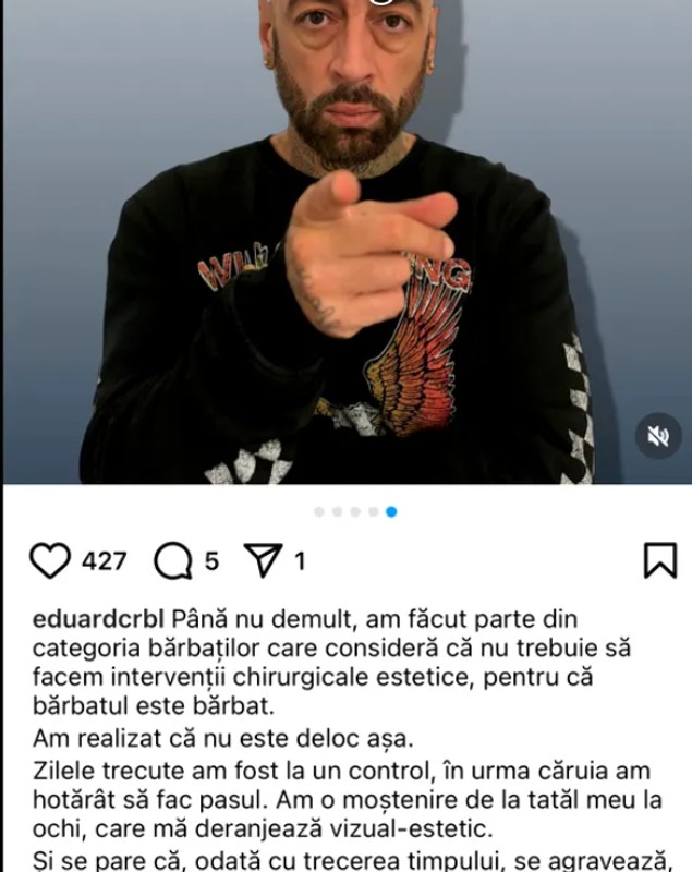 CRBL își face prima intervenție estetică. De ce a luat această decizie. „Se pare că, odată cu trecerea timpului, se agravează”