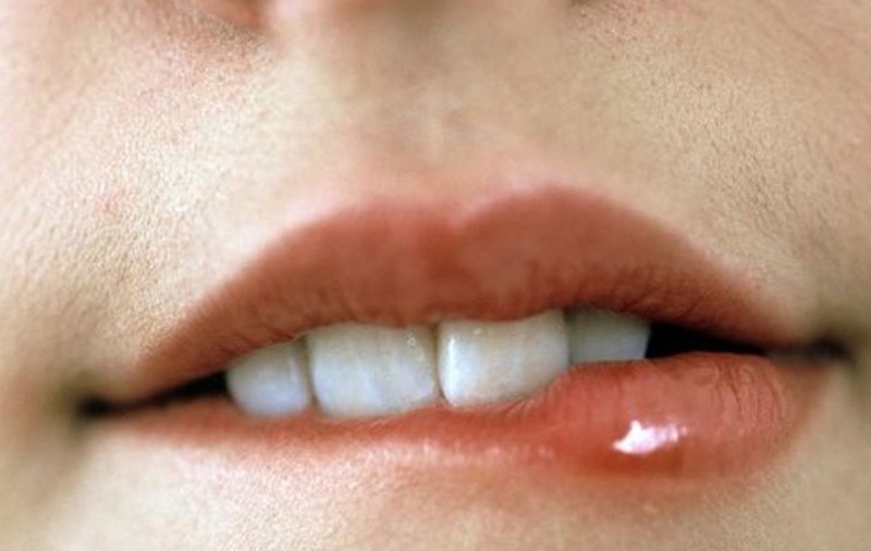 3 tratamente naturiste pentru herpes