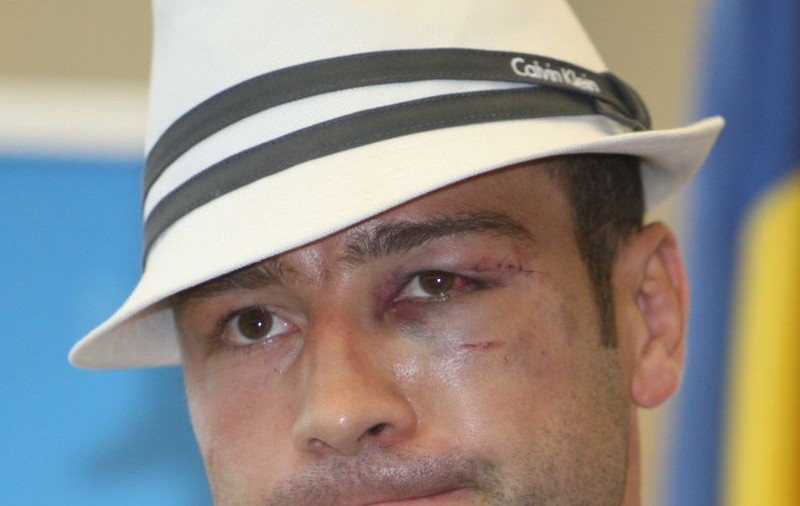 Lucian Bute a fost OPERAT la arcadă. Află cât va sta departe de ring!