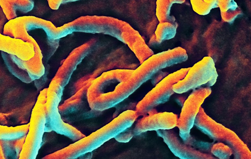 Test de depistare a Ebola în 30 de minute, inventat de japonezi