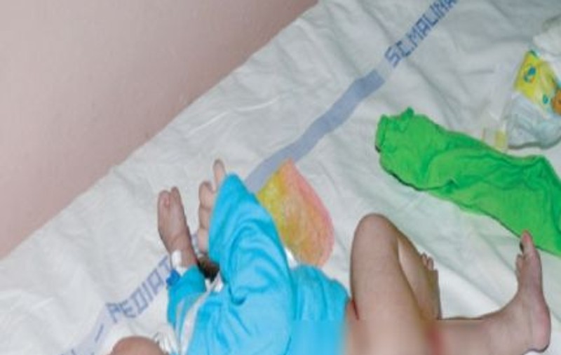 Un nou-născut riscă să-şi piardă un picior