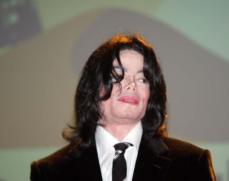 Câte operații estetice a avut, de fapt, Michael Jackson. Multiple cicatrici i-au fost descoperite la autopsie
