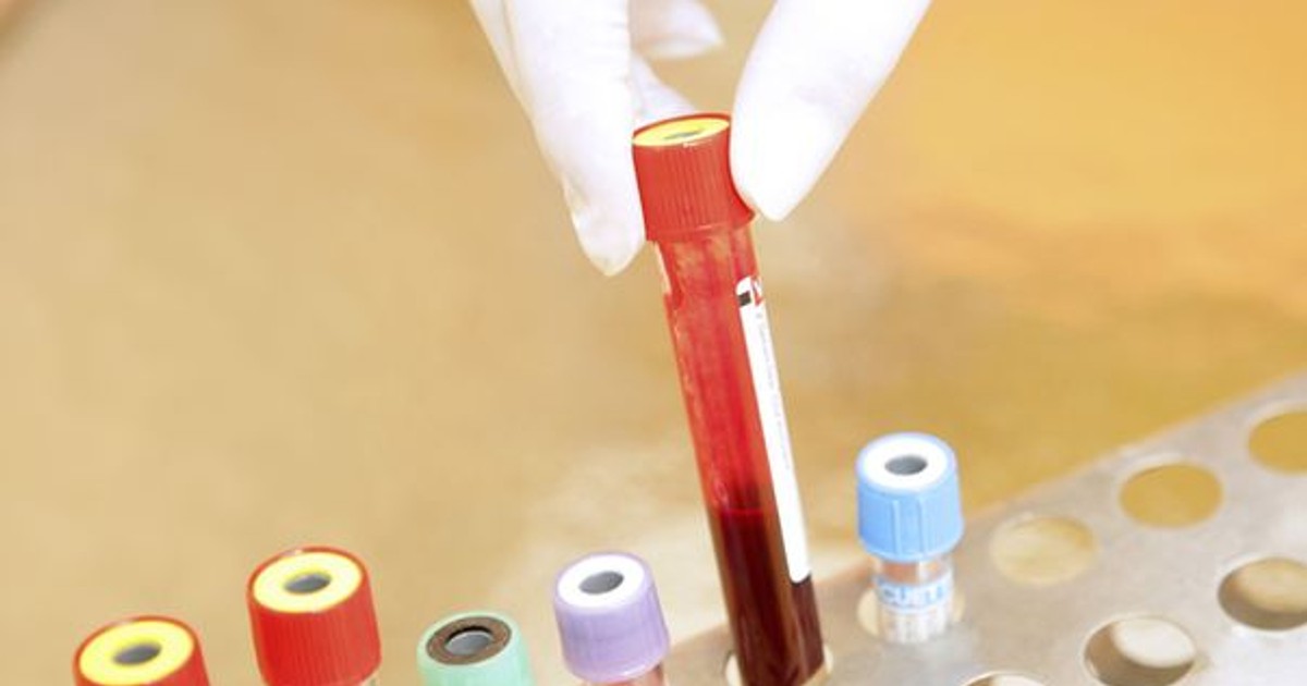 Un medicament care împiedică transmiterea HIV