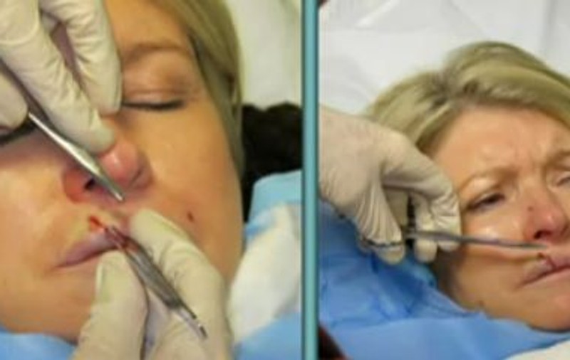 Video | Martha Stewart a fost desfigurată de căţeaua sa