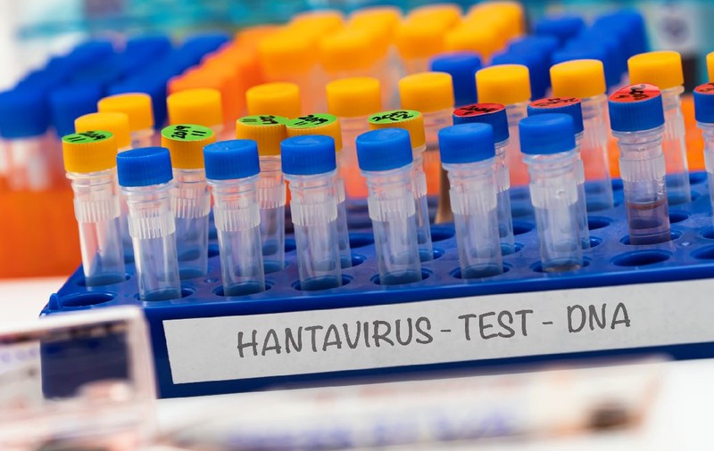 Dr. Adrian Marinescu, despre cazul de hantavirus din România: „E o isterie! Virusul e banal, nu are nicio legătură cu ce s-a întâmplat pe vapor și nu este de import”