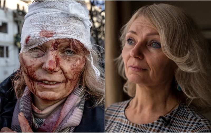 EXCLUSIV la un an de război. Femeia-simbol, rănită într-un bloc de locuințe în primul bombardament rusesc, interviu pentru români: „Încă mă tratez. Visez bombe, rachete, explozii”