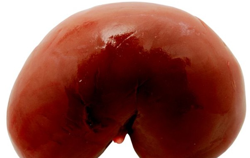 A murit omul care a realizat PRIMUL TRANSPLANT de RINICHI din LUME