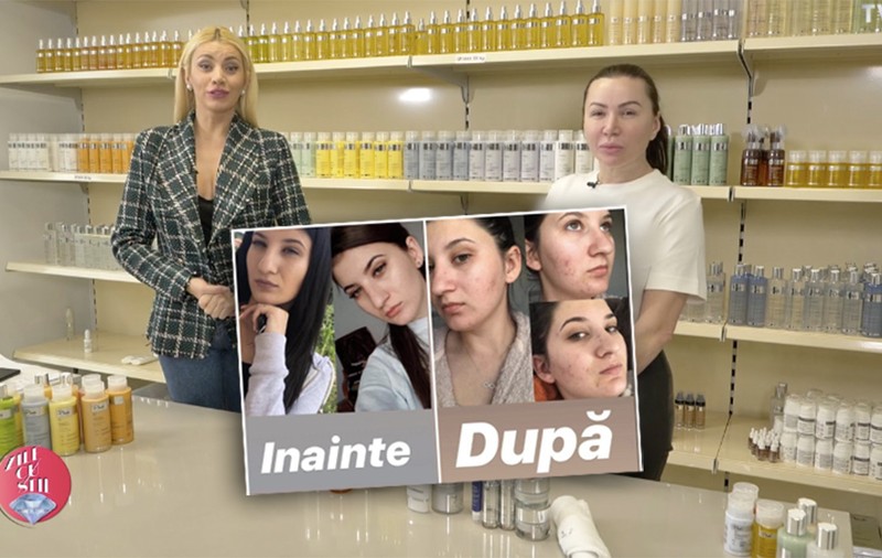 Opt luni de la scandalul Plush Bio. Niciun vinovat, tinere care nu au fost chemate la audieri, produse pentru ten promovate la TVR