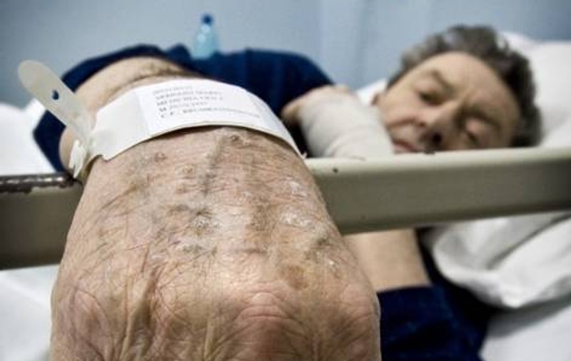 Americanii au descoperit un nou aliat contra cancerului de piele… banala cafea de dimineaţă!