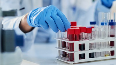 teste de sânge