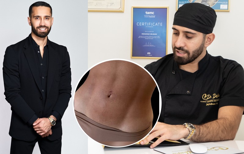 Sfaturi esențiale de la Dr. Delbani pentru recuperarea rapidă după intervenția de liposucție abdominală Vaser HD