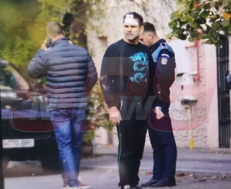 Florin Pastramă s-a ales cu răni în zona frunții (foto:spynews.ro)