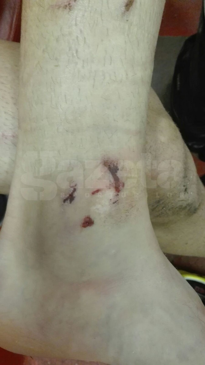 Miha Mevlja are glezna paradită după intervenția lui Bourceanu FOTO: gsp.ro