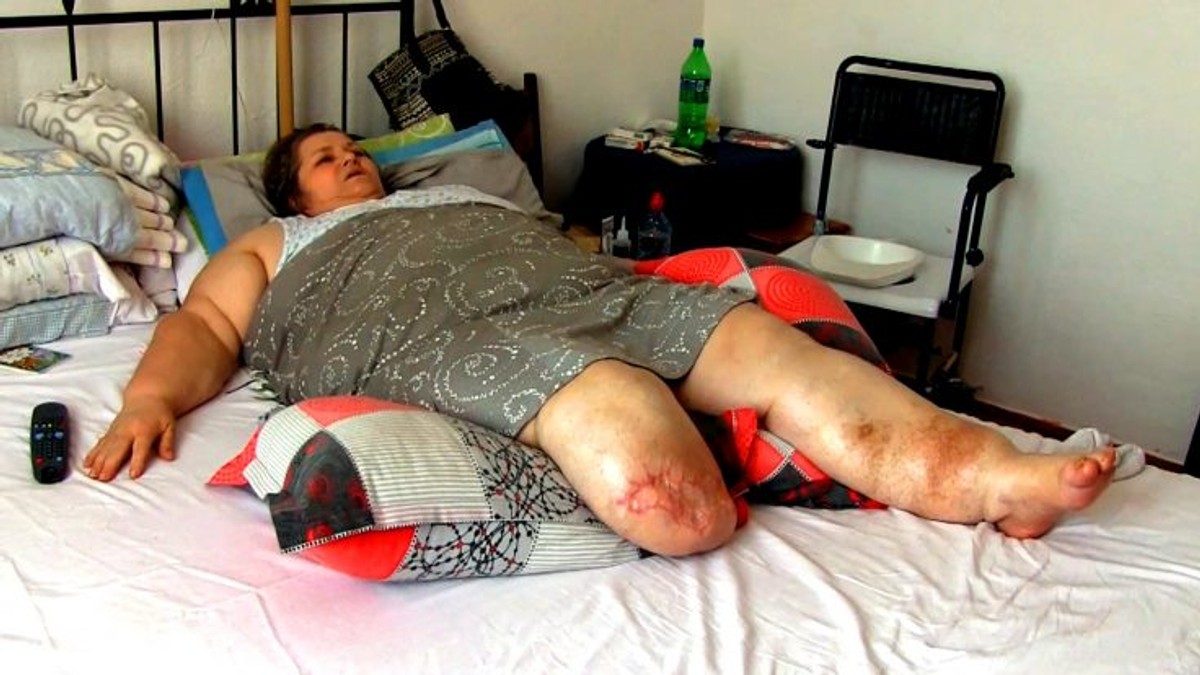 Femeie din Neamț de 140 de kilograme, umilită de serviciile sociale