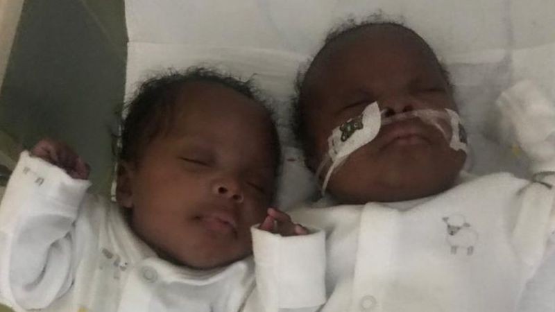 Gemenii au apărut pe lume la doar 26 de săptămâni (Foto din arhiva familiei / BBC)