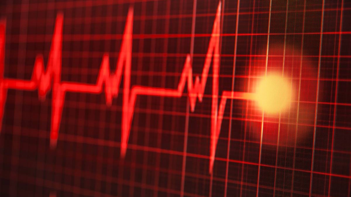 Bataile inimii pe un monitor EKG, linie cardiacă