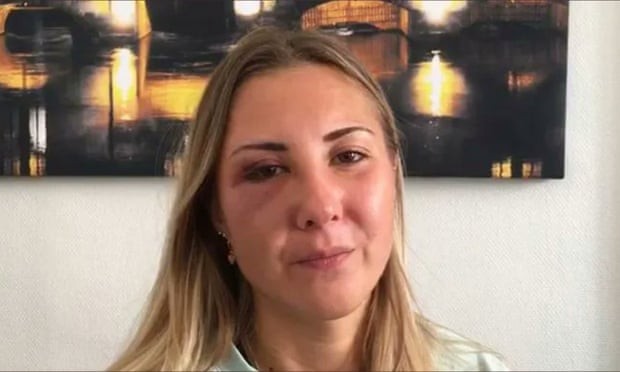O fotografie cu Elisabeth, care are un ochi vânăt, a fost postată pe Twitter și a stârnit furia internauților