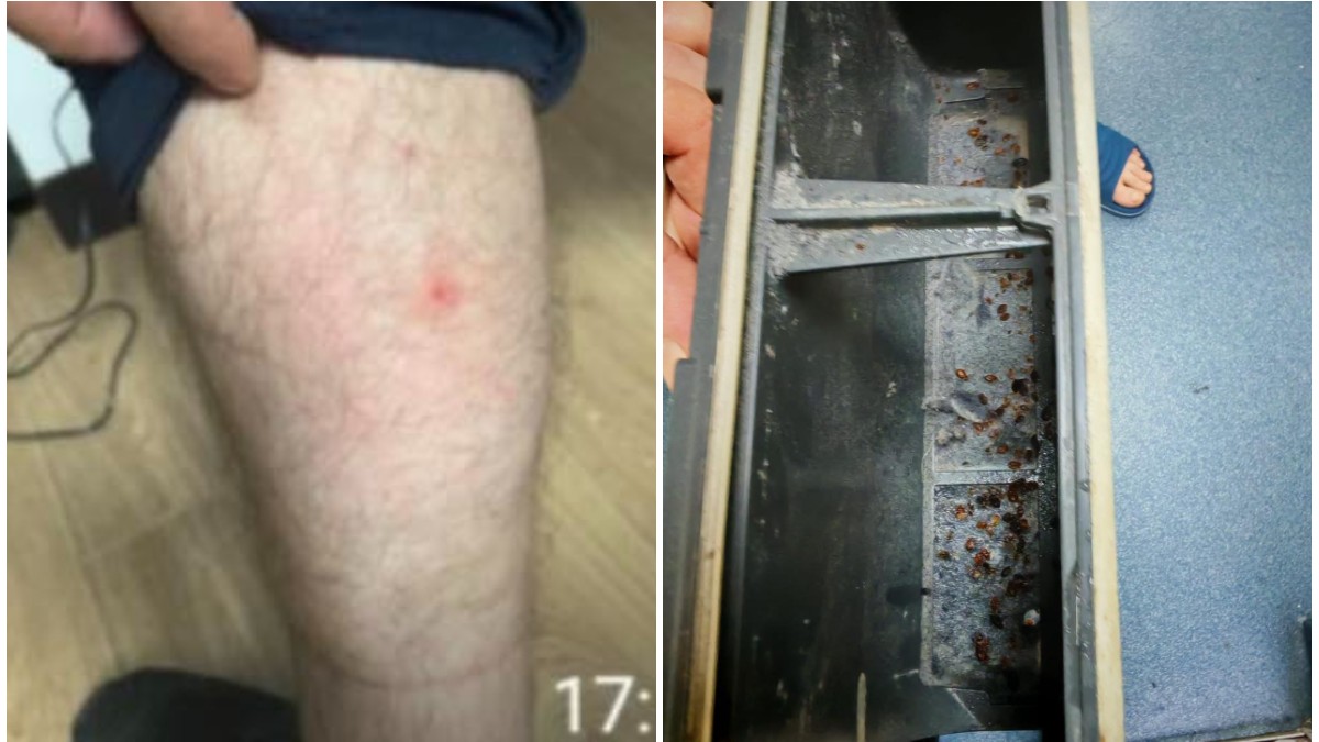 Bărbat mușcat de ploșnițe în partea stângă. În partea dreaptă sunt mai multe ploșnițe în sediile Poliției Capitalei