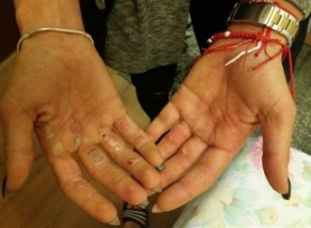 Palmele tăbăcite de vâslit ale vedetei lotului, Denisa Tîlvescu, dublă medaliată cu aur la Glasgow: probele Dublu rame (W2-) și 8 plus unu (W8+)